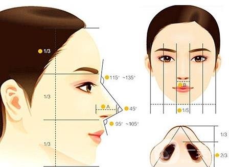 假體隆鼻整型術(shù)術(shù)前準(zhǔn)備有哪些？