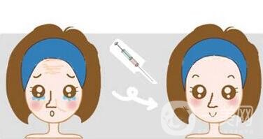 玻尿酸保持時間是多久？如何延長保持時間？