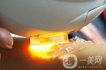 彩光嫩膚的價(jià)格一般是多少？