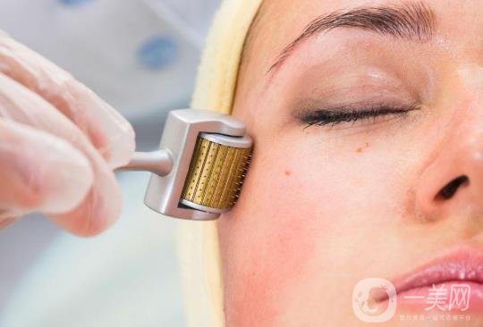 果酸換膚一次多少錢？要做幾次才*？