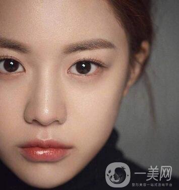 如何讓鼻梁變高？可以注射玻尿酸嗎？