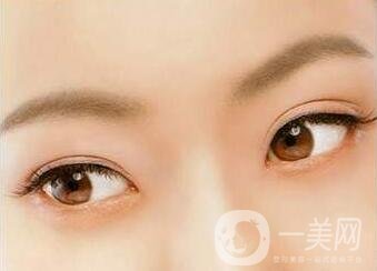 三點(diǎn)定位雙眼皮手術(shù)后應(yīng)該注意些什么？