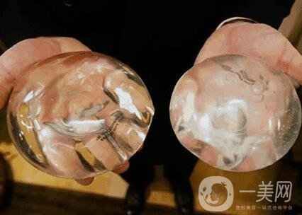 胸部整形術(shù)要多少錢?大概價(jià)位說(shuō)明