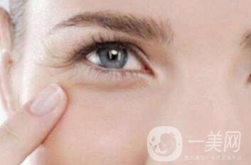 魚尾紋除皺手術(shù)哪種方法見*比較快?