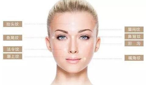 魚尾紋除皺手術(shù)哪種方法見*比較快?