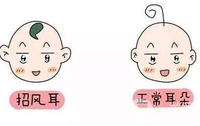 招風(fēng)耳手術(shù)多少錢?醫(yī)院收費(fèi)情況說(shuō)明