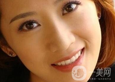 墊個鼻子要多少錢？大概價位是多少？