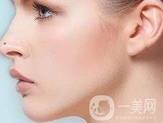 墊個鼻子要多少錢？大概價位是多少？