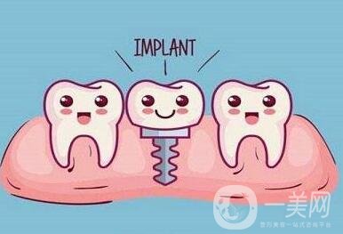 貴金屬烤瓷牙有哪些種類(lèi)？