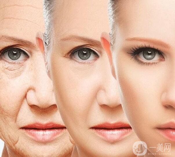 *祛皺對法令紋*嗎?能保持多久?