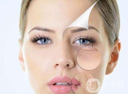 *去皺多久能見*?*果能維持多久?