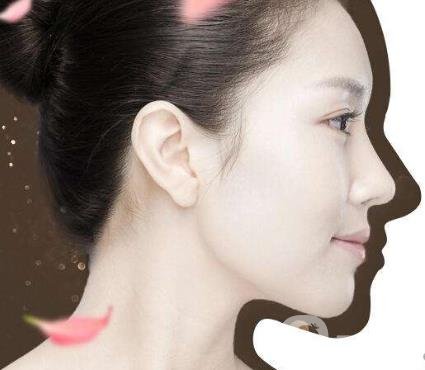 韓式立體隆鼻術(shù)的*果怎么樣？