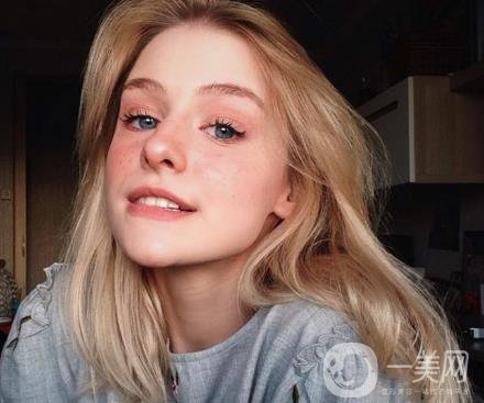 紅寶石激光祛斑多少錢？術(shù)后怎么護理？