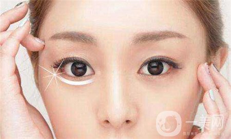 瑞蘭隆鼻多少錢？需要幾支？