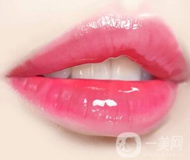 豐唇手術(shù)價(jià)格貴不貴？要多少錢(qián)？