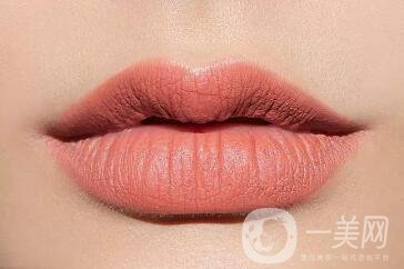 豐唇手術(shù)價(jià)格貴不貴？要多少錢(qián)？