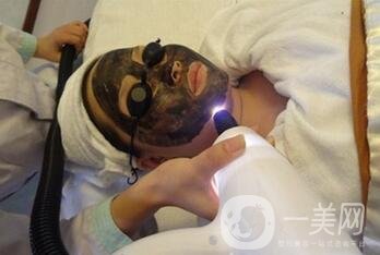 黑臉娃娃能去黑頭嗎？