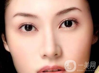 吸雕雙眼皮手術(shù)是什么？是埋線嗎？