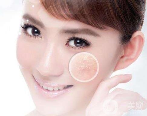 像素激光去痘的*果好嗎？會反彈嗎？