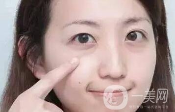 激光去眼袋疼嗎?需要打麻藥嗎?