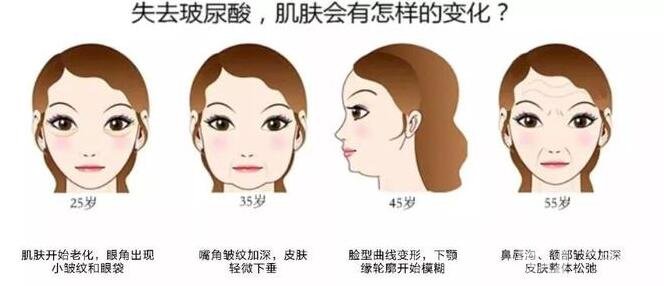 注射瑞藍(lán)玻尿酸價格是全國統(tǒng)一的嗎?有哪些區(qū)別