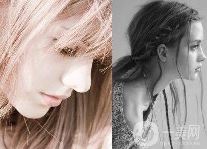 怎樣讓鼻子變高？隆鼻可以讓鼻子變高嗎？