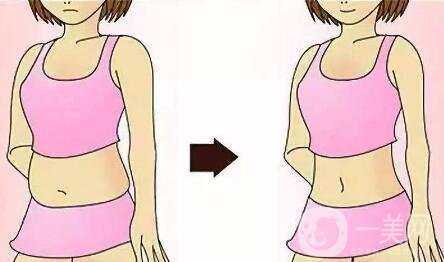 什么是環(huán)形吸脂減肥？優(yōu)點有哪些？