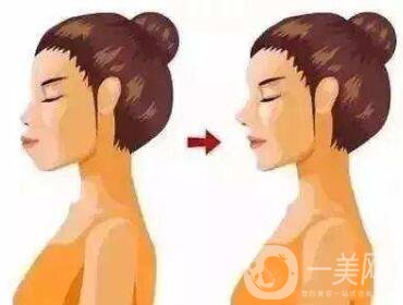 雙頜前突帶牙套可以矯正嗎？