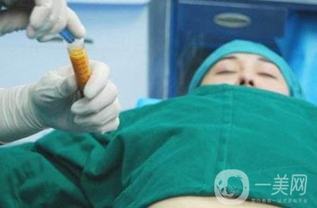 全身抽脂手術(shù)要多久？要花多少錢？