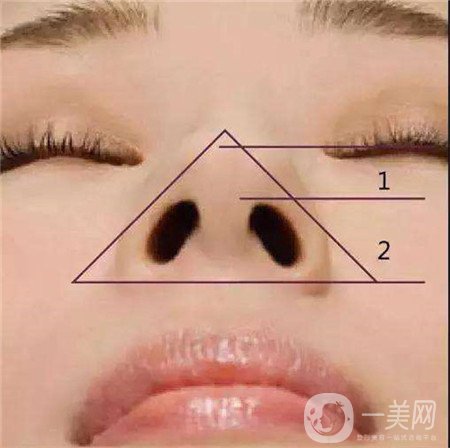 鼻頭縮小手術(shù)價(jià)錢大概是多少？