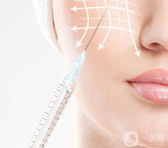 【至小白篇】玻尿酸有幾種品牌和類型?