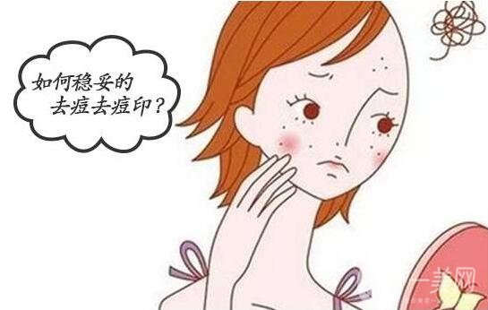 怎么樣去除痘印?哪種方法*靠譜?