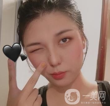 六盤水友好整形醫(yī)院雙眼皮