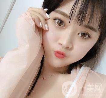 蘭州美奧整形醫(yī)院耳軟骨隆鼻