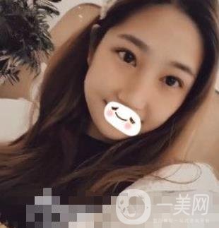 濟(jì)南旭美整形醫(yī)院靠譜嗎?附雙眼皮案例和全新價(jià)格表