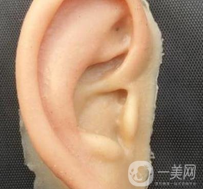 2020年石家莊第(一)醫(yī)院整形美容科價格表和耳朵畸形修復案例一覽