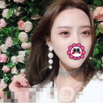 溫嶺芘麗芙整形醫(yī)院2020年價格表更新_雙眼皮整形*果實拍