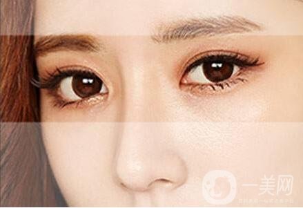 三點雙眼皮和全切信息介紹?