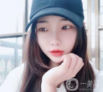 東京湘南美容醫(yī)院 瘦臉