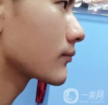 濰坊市人民醫(yī)院 整牙齒