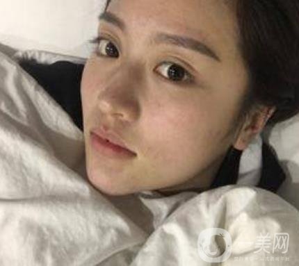 河北省人民醫(yī)院整形外科價格表新版來襲，附去下頜骨案例