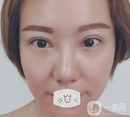 綿陽(yáng)中心醫(yī)院整形美容科價(jià)格表2020發(fā)布，附祛眼袋案例