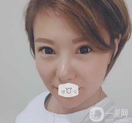 綿陽(yáng)中心醫(yī)院整形美容科價(jià)格表2020發(fā)布，附祛眼袋案例