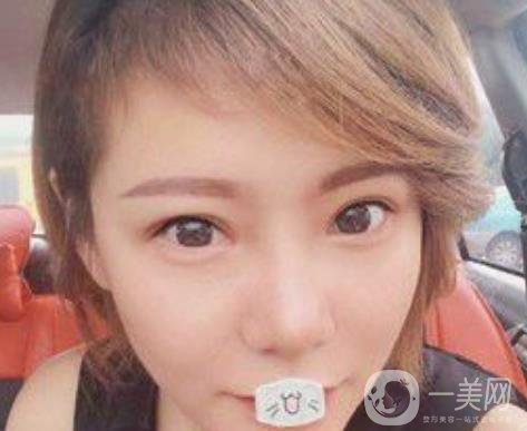 綿陽(yáng)中心醫(yī)院整形美容科價(jià)格表2020發(fā)布，附祛眼袋案例