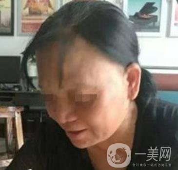 廣東省人民醫(yī)院整形科價格表，附祛斑整形日記