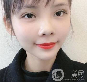 西安交通大學附屬醫(yī)院整形美容科價格表和雙眼皮案例一覽