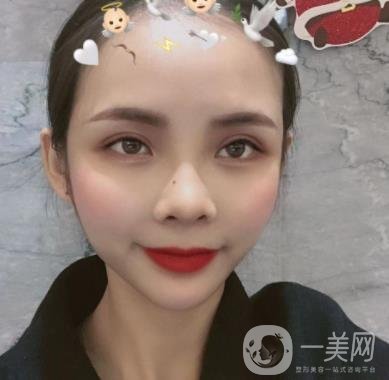 西安交通大學附屬醫(yī)院整形美容科價格表和雙眼皮案例一覽