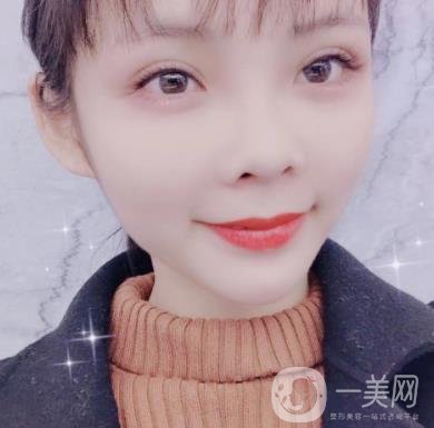 西安交通大學附屬醫(yī)院整形美容科價格表和雙眼皮案例一覽