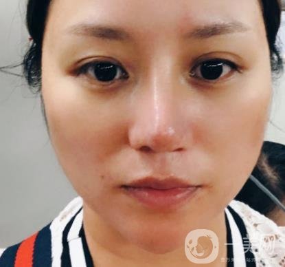 張掖市人民醫(yī)院美容整形科價(jià)格表，附眼袋切除*果圖