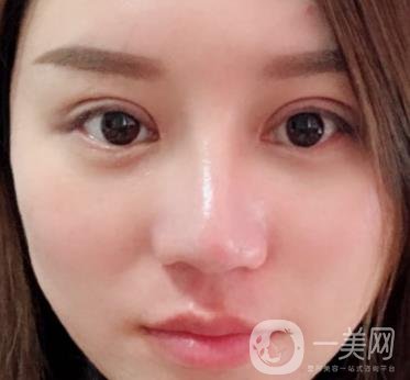 張掖市人民醫(yī)院美容整形科價(jià)格表，附眼袋切除*果圖